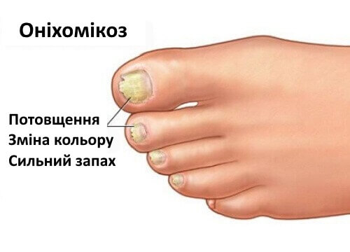 Гриби