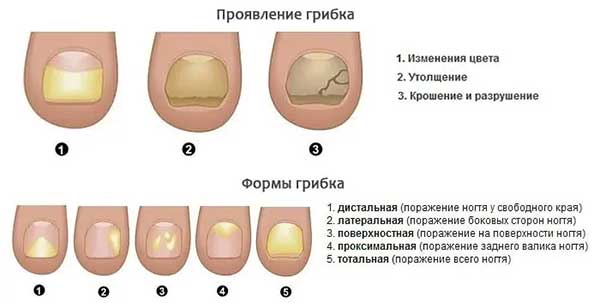 Гриби